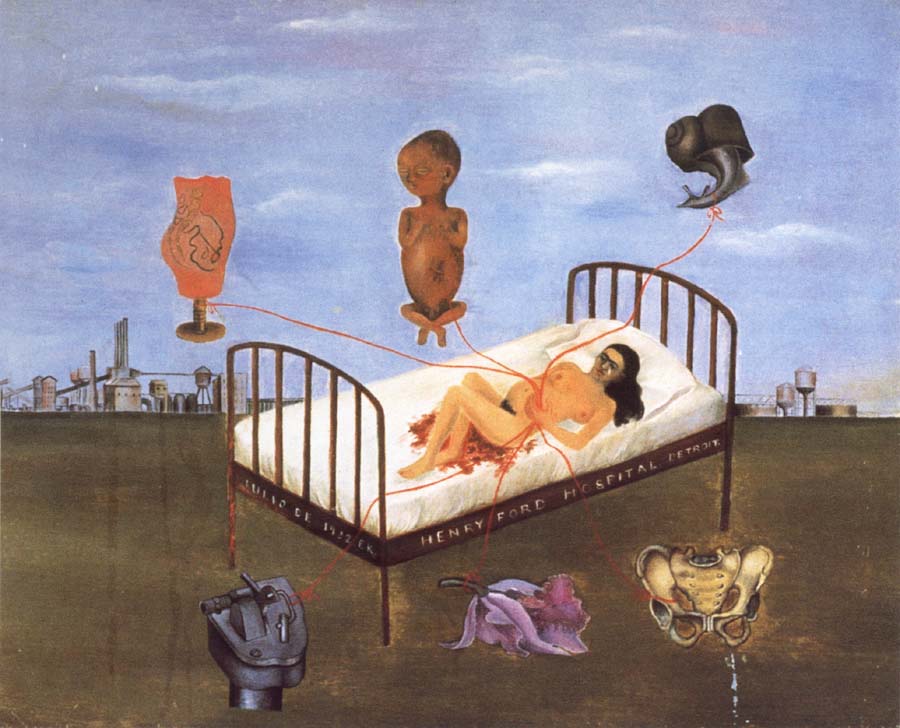 Henry Ford Hospital portrays Frida Kahlo-s Loss of he second pregnancy.